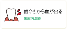 歯ぐきから血が出る