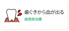 歯ぐきから血が出る